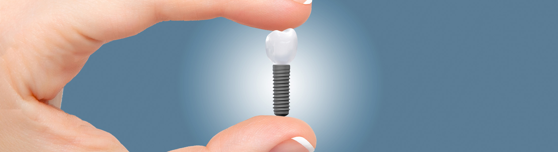 Mehr als 40.000 Implantate erfolgreich gesetzt
